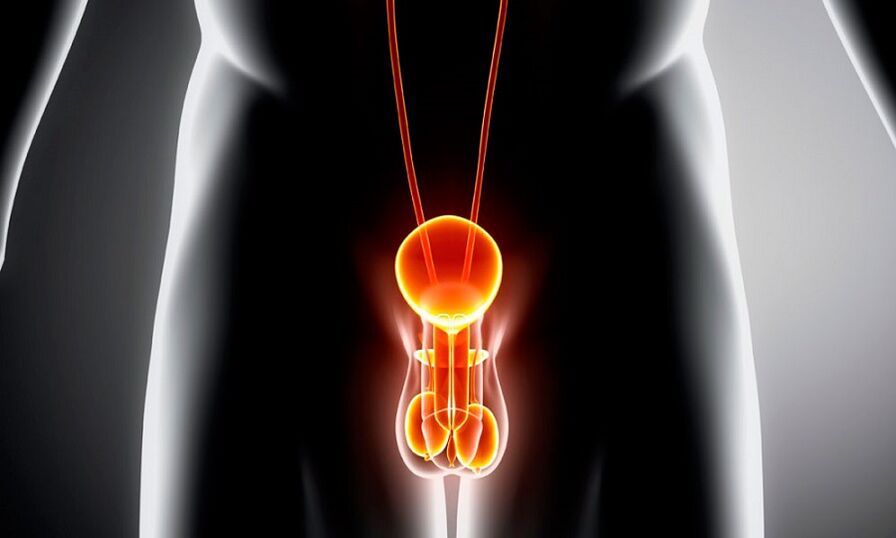 sistema geniturinário inflamado para prostatite